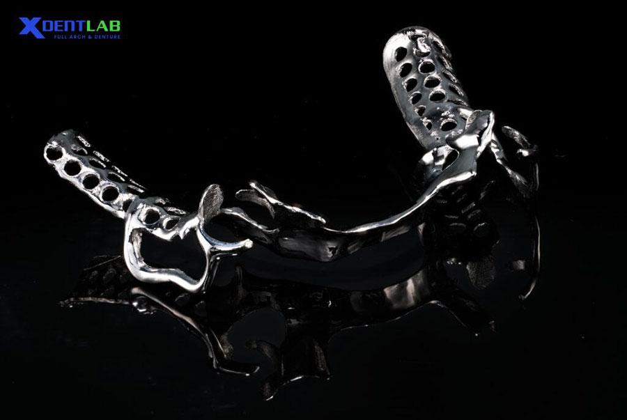 Metal Partial Denture (Chrome Cobalt or titanium framework) Metal Partial Denture (Chrome Cobalt or titanium framework)