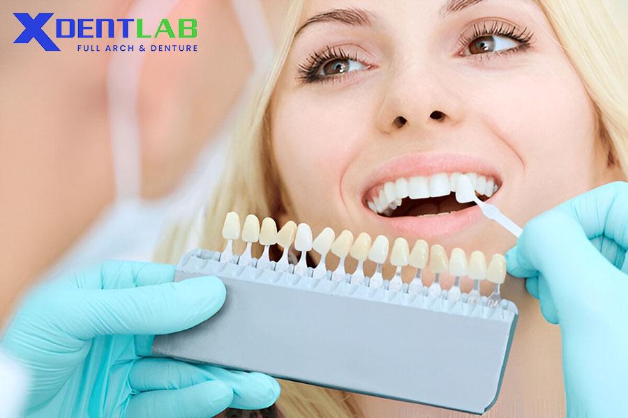 The color of the porcelain teeth The color of the porcelain teeth