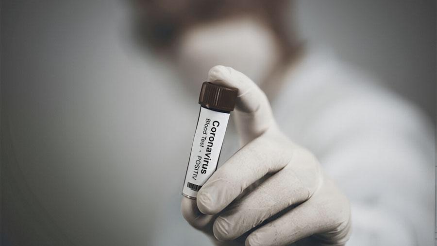 The Impact Of Covid On The Dental Outsourcing Market