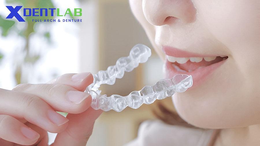 The Role Of Night Guard For Bruxism Treatment