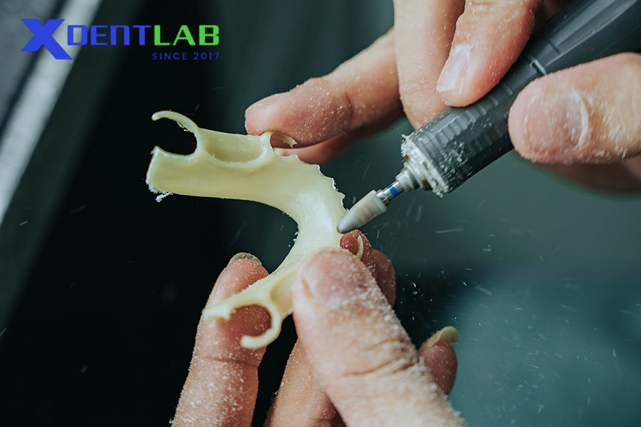 Vì Sao Nên Chọn XDENT LAB Cho Khung Acetal?
