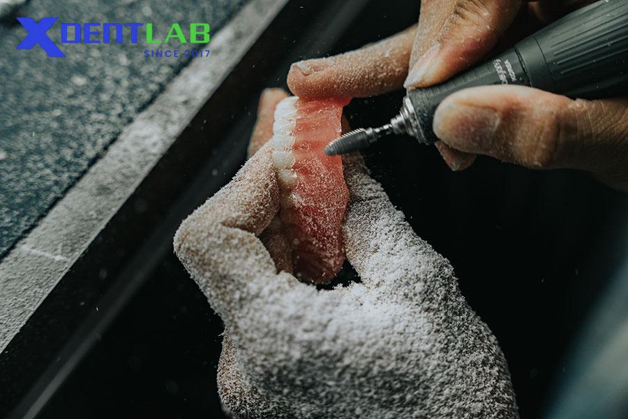 Tương Lai Của Labo Gia Công Nha Khoa Tương Lai Của Labo Gia Công Nha Khoa