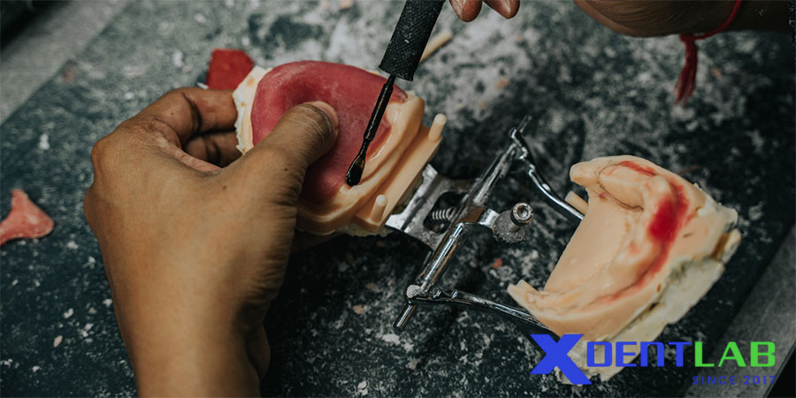 Why Bite Blocks Are Important? Why Bite Blocks Are Important?