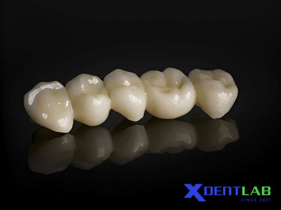 What is Monolithic Zirconia? What is Monolithic Zirconia?
