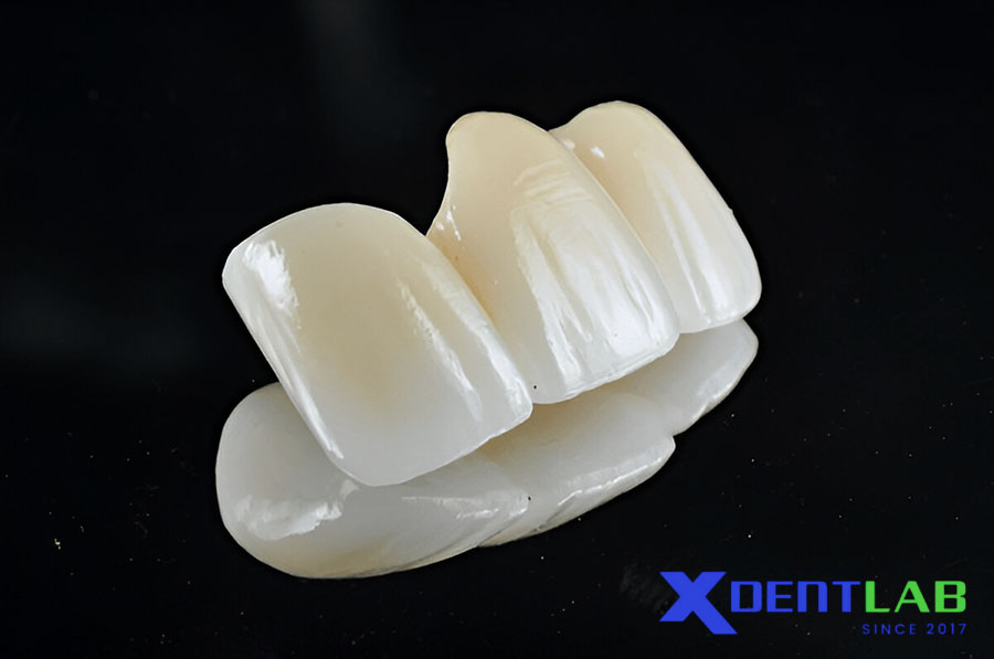 What is Esthetic Multilayer Zirconia? What is Esthetic Multilayer Zirconia?