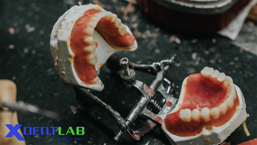Dịch vụ lab-to-lab nha khoa tại Việt Nam mang lại sự kết hợp hấp dẫn giữa chi phí hợp lý, chất lượng cao và hiệu quả tối ưu Dịch vụ lab-to-lab nha khoa tại Việt Nam mang lại sự kết hợp hấp dẫn giữa chi phí hợp lý, chất lượng cao và hiệu quả tối ưu