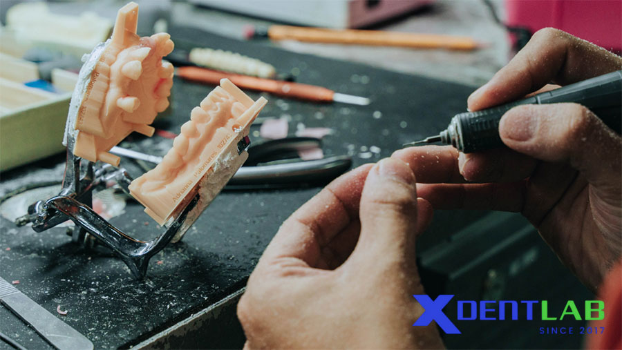So sánh các yếu tố chính So sánh các yếu tố chính