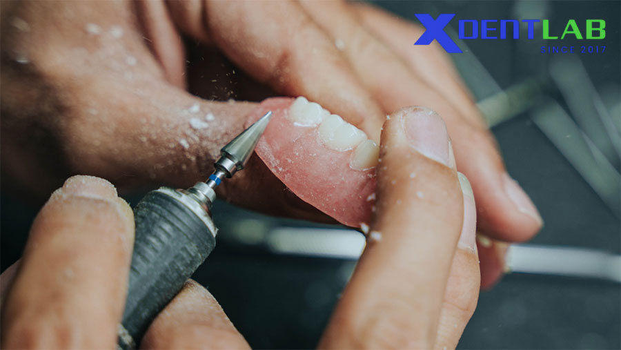 Tầm Quan Trọng Của Độ Chính Xác Trong Sản Xuất Răng Giả Tầm Quan Trọng Của Độ Chính Xác Trong Sản Xuất Răng Giả
