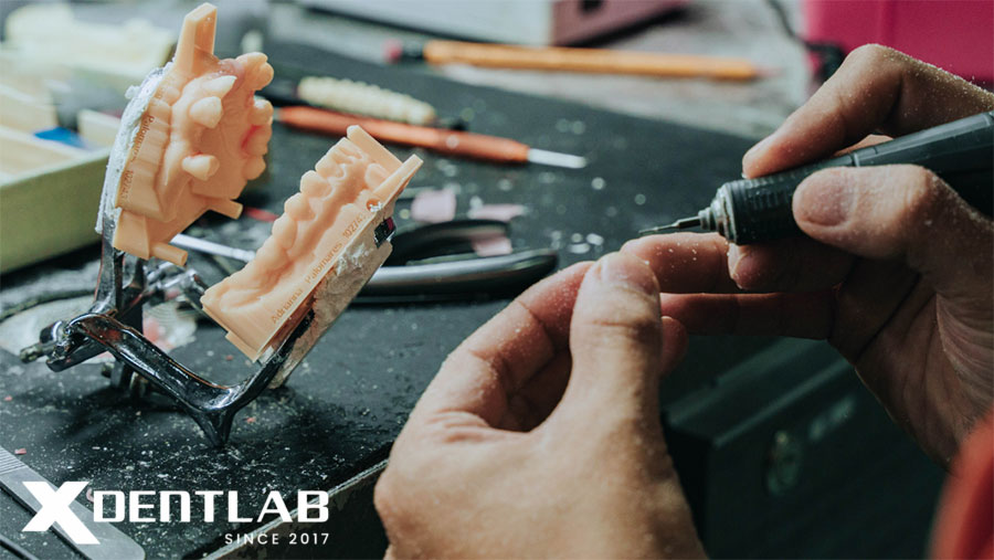 Thách Thức Của Kỹ Thuật Viên Labo Răng Giả Thách Thức Của Kỹ Thuật Viên Labo Răng Giả