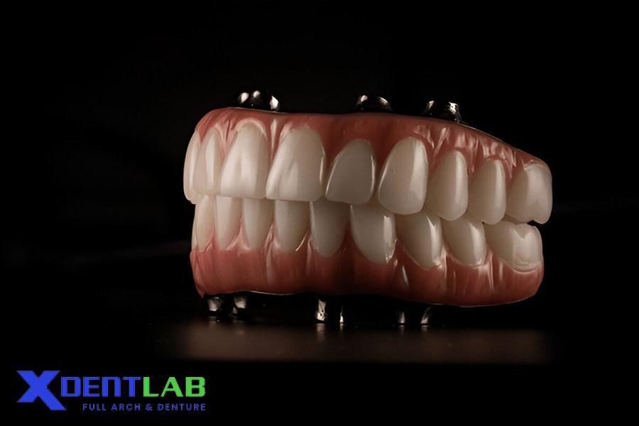 Phục Hình Toàn Hàm – Mão Răng, Cầu Răng, Implant Phục Hình Toàn Hàm – Mão Răng, Cầu Răng, Implant