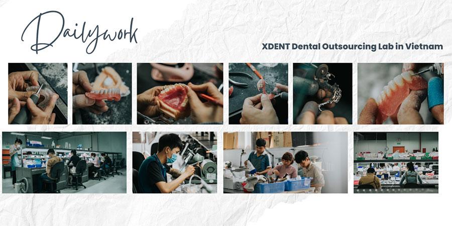 XDENT LAB - Labo gia công nha khoa tại Việt Nam XDENT LAB - Labo gia công nha khoa tại Việt Nam