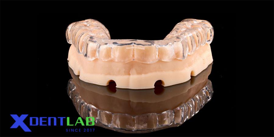 Vì Sao Độ Dày Quan Trọng Đối Với Máng Chống Nghiến Cứng Vì Sao Độ Dày Quan Trọng Đối Với Máng Chống Nghiến Cứng