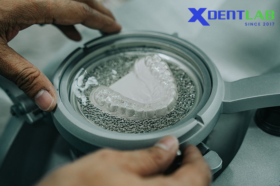 Vì Sao Nên Chọn XDENT LAB Cho Sản Xuất Máng Chống Nghiến Kỹ Thuật Số?