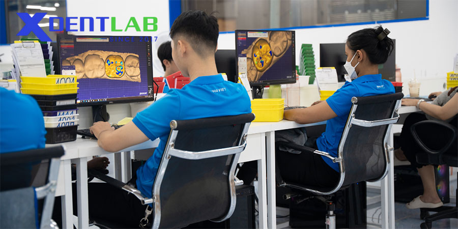 Vì Sao Nên Chọn Labo Nha Khoa Việt Nam? Vì Sao Nên Chọn Labo Nha Khoa Việt Nam?