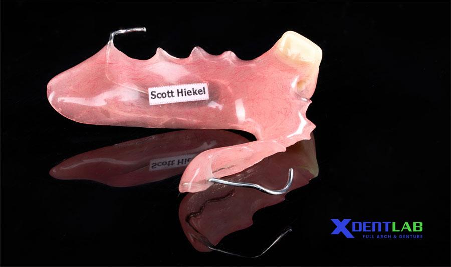 Choose XDENT LAB as Your Dental Lab in the USA Choose XDENT LAB as Your Dental Lab in the USA