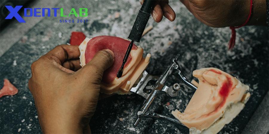 Răng Tháo Lắp Thủ Công – Nghệ Thuật Vượt Thời Gian Răng Tháo Lắp Thủ Công – Nghệ Thuật Vượt Thời Gian