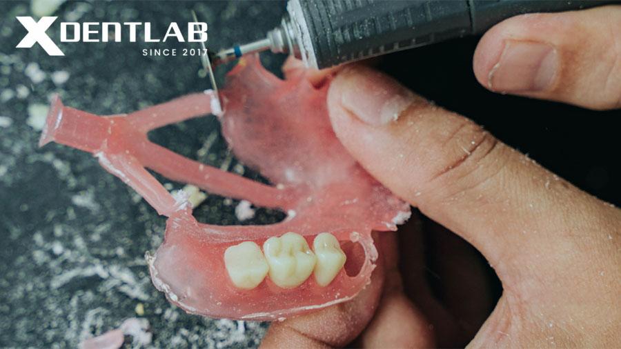 Personalized Customer Experience in Dental Lab