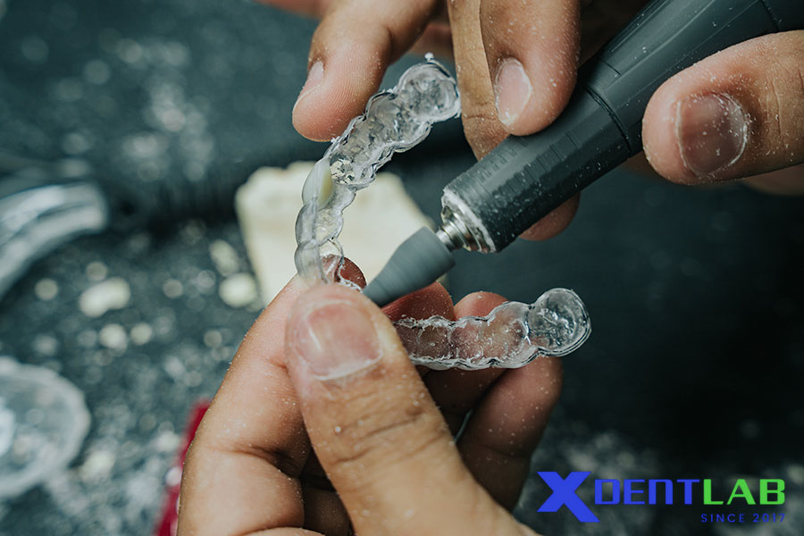 Vì Sao Nên Chọn XDENT LAB Gia Công Máng Chống Nghiến?