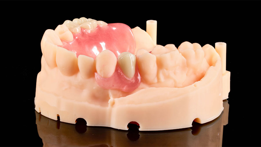 Potential Partners For High-Quality Denture Outsourcing Products