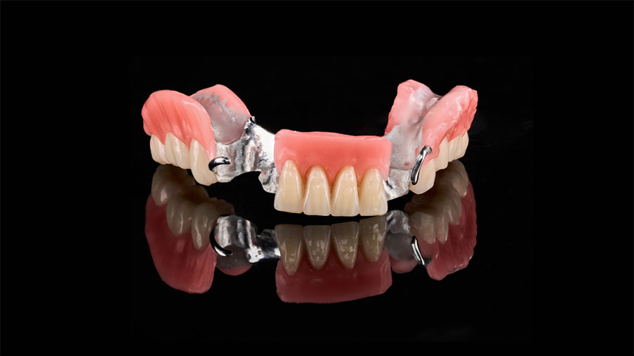 Removable Dentures from Vietnam: Why Labs Prefer Lab-to-Lab Solutions?