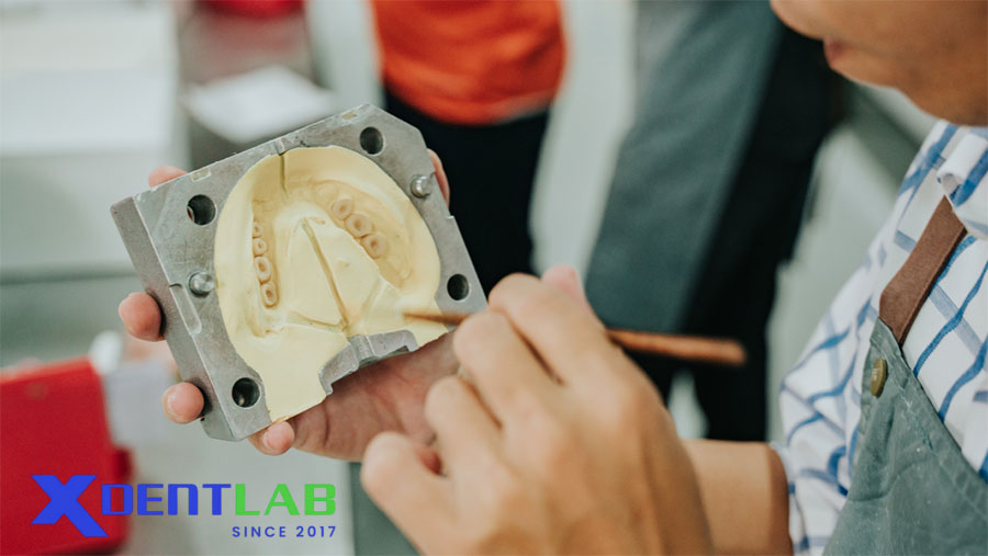 Why Vietnam is Becoming a Hub for Lab-to-Lab Solutions in Removable Dentures Production Why Vietnam is Becoming a Hub for Lab-to-Lab Solutions in Removable Dentures Production