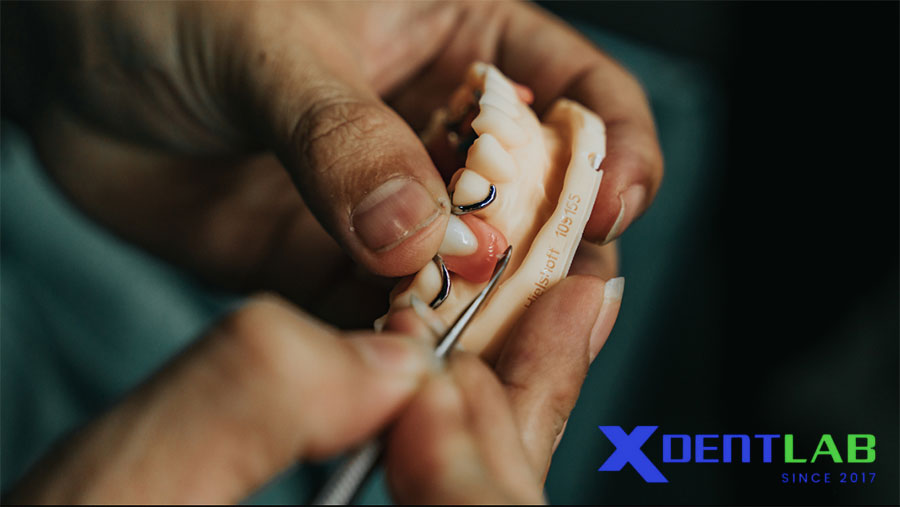 Vì Sao Việt Nam Trở Thành Trung Tâm Gia Công Labo Nha Khoa Hàng Đầu? Vì Sao Việt Nam Trở Thành Trung Tâm Gia Công Labo Nha Khoa Hàng Đầu?