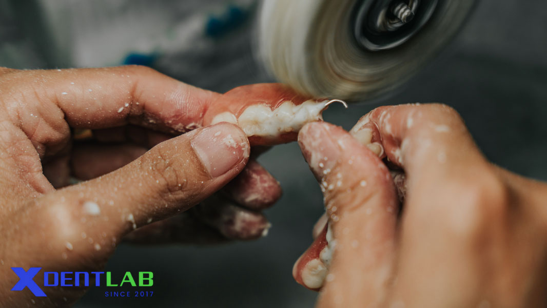 Dịch Vụ Gia Công Phục Hình Tháo Lắp Chuyên Biệt Cho Labo Mỹ Dịch Vụ Gia Công Phục Hình Tháo Lắp Chuyên Biệt Cho Labo Mỹ