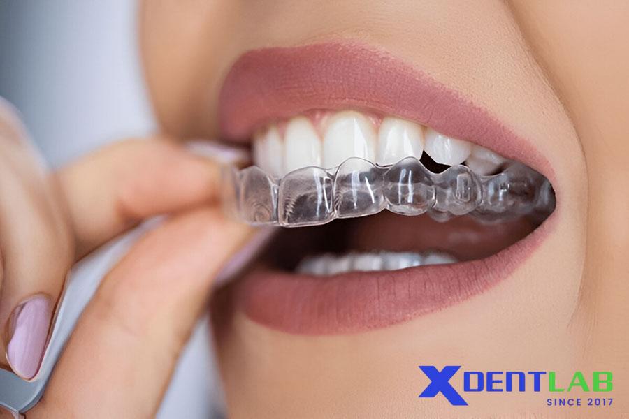 The Future of Night Guards in the Dental Industry The Future of Night Guards in the Dental Industry