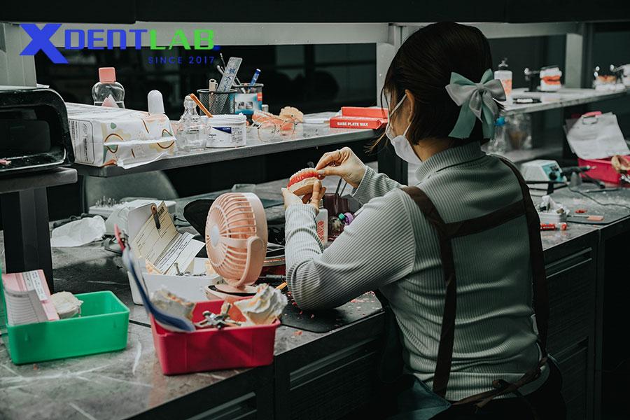 Giới Thiệu Dịch Vụ Gia Công Sản Xuất Máng Chống Nghiến Tại XDENT LAB Giới Thiệu Dịch Vụ Gia Công Sản Xuất Máng Chống Nghiến Tại XDENT LAB