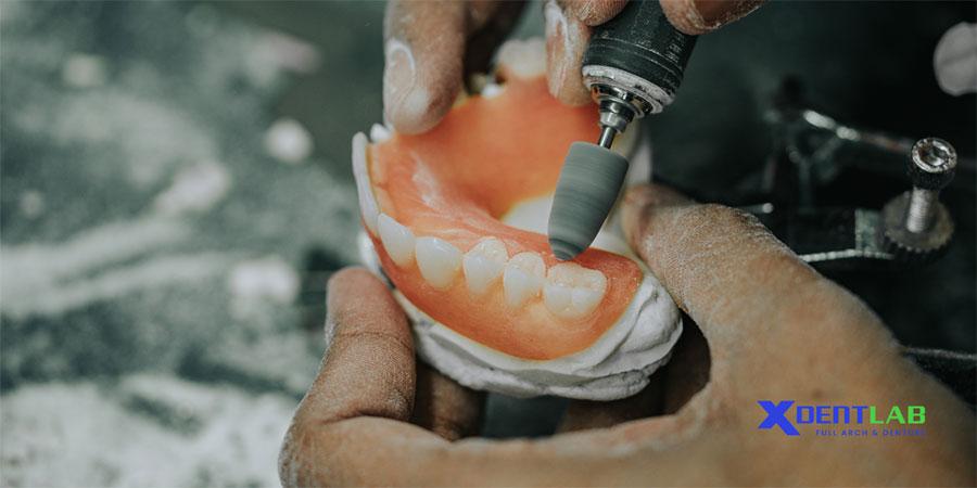 Những Tiêu Chí Cần Xem Xét Khi Chọn Labo Nha Khoa Những Tiêu Chí Cần Xem Xét Khi Chọn Labo Nha Khoa