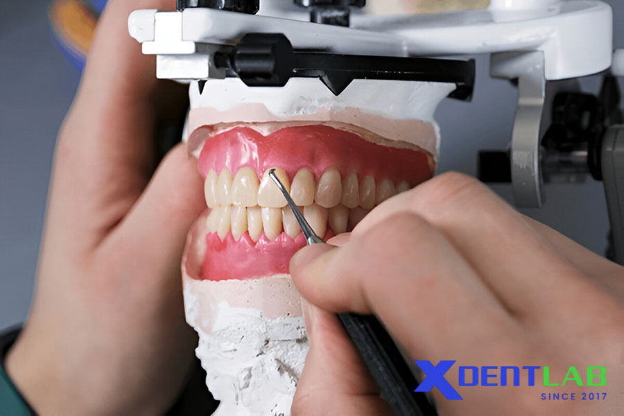 Ứng Dụng Của Wax Bite Block Ứng Dụng Của Wax Bite Block