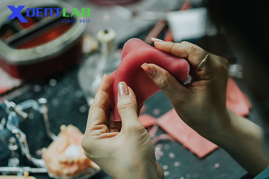 Các Bước Chế Tác Wax Bite Block Tại Labo Nha Khoa