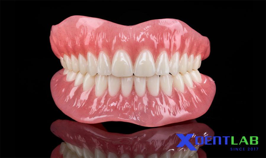 Răng Giả Toàn Hàm (Full Denture) Răng Giả Toàn Hàm (Full Denture)