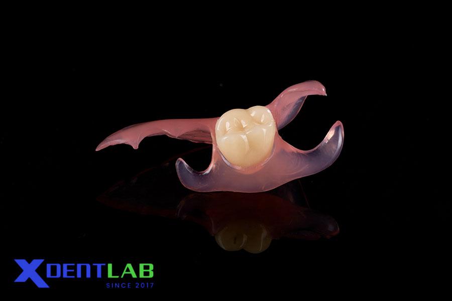 Răng Giả Tháo Lắp Mềm (Flexible Partial Denture) Răng Giả Tháo Lắp Mềm (Flexible Partial Denture)