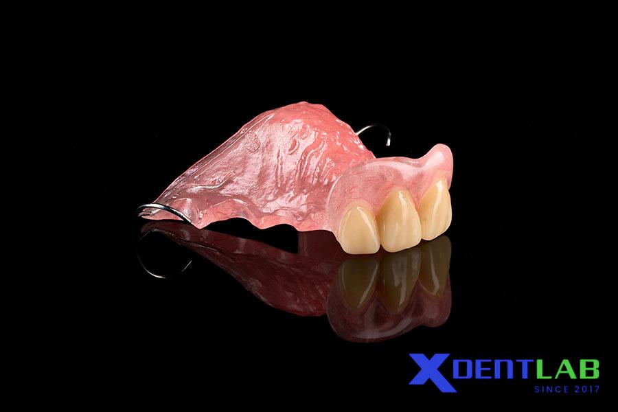 Răng Giả Tháo Lắp Nhựa (Acrylic Partial Denture) Răng Giả Tháo Lắp Nhựa (Acrylic Partial Denture)