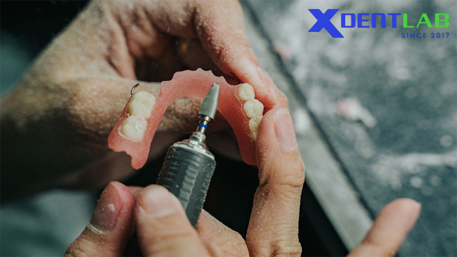 Where to Produce High-Quality Acrylic Partial Dentures? Where to Produce High-Quality Acrylic Partial Dentures?