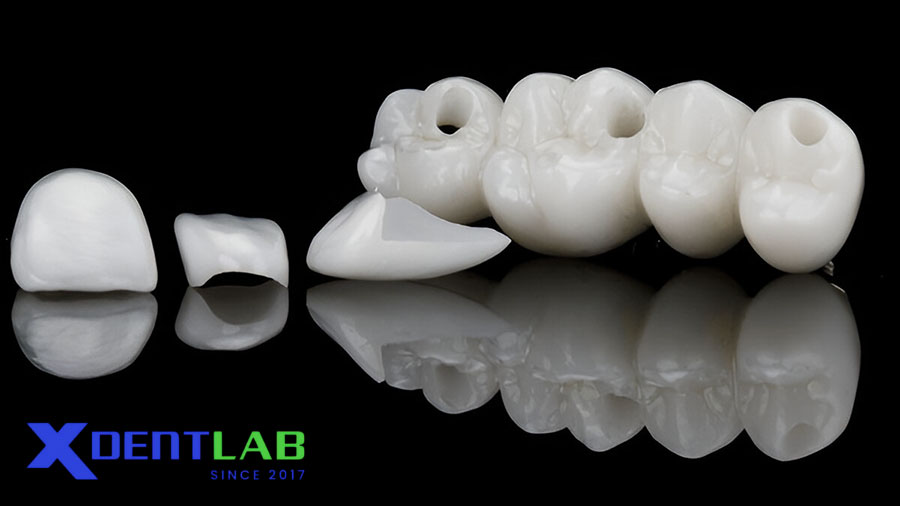 Classification of Dental Ceramics Classification of Dental Ceramics
