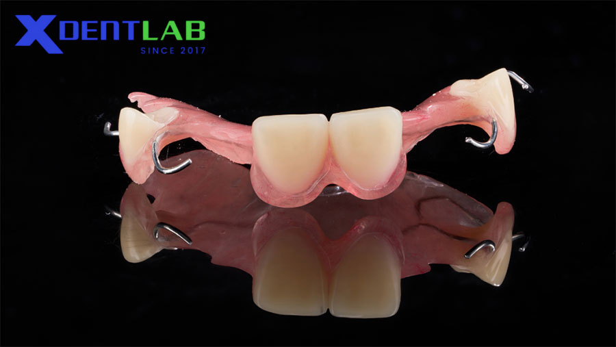 Hàm Giả Bán Phần (Partial Denture) Là Gì? Hàm Giả Bán Phần (Partial Denture) Là Gì?