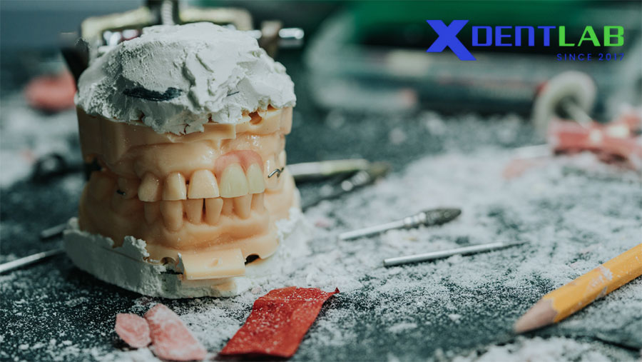 Collaborate with XDENT LAB Collaborate with XDENT LAB