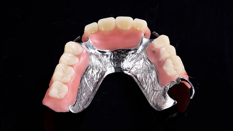 dental-lab-outsourcing-key-trends-for-2025