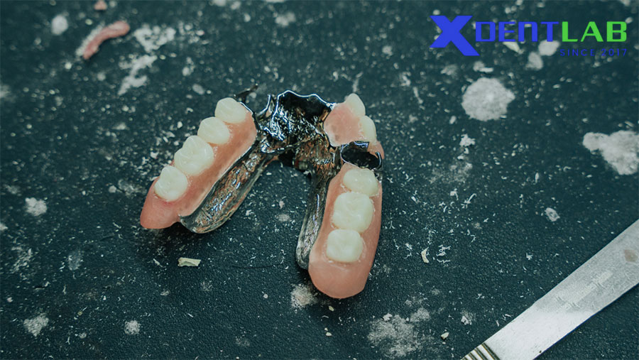 Cách Chọn Đơn Vị Sản Xuất Khung Hàm Giả Bán Phần Phù Hợp? Cách Chọn Đơn Vị Sản Xuất Khung Hàm Giả Bán Phần Phù Hợp?