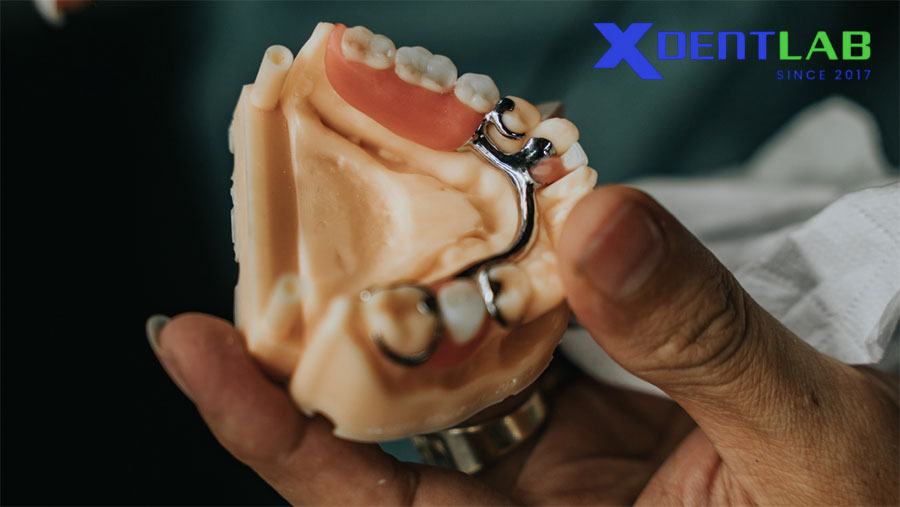 Lựa chọn labo nha khoa phù hợp tại Washington, là yếu tố quyết định chất lượng phục hình và sự hài lòng của bệnh nhân Lựa chọn labo nha khoa phù hợp tại Washington, là yếu tố quyết định chất lượng phục hình và sự hài lòng của bệnh nhân