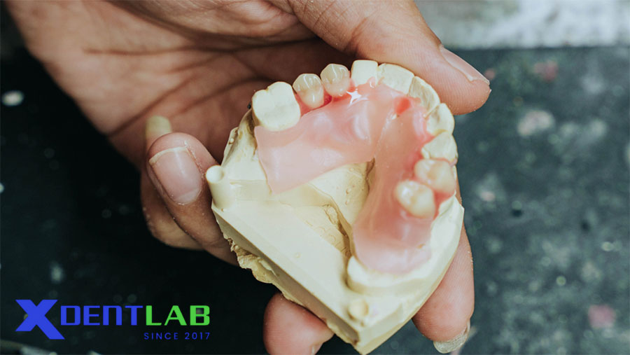 Ưu Nhược Điểm Của Labo Nội Bộ Và Hợp Tác Labo-to-Labo Ưu Nhược Điểm Của Labo Nội Bộ Và Hợp Tác Labo-to-Labo