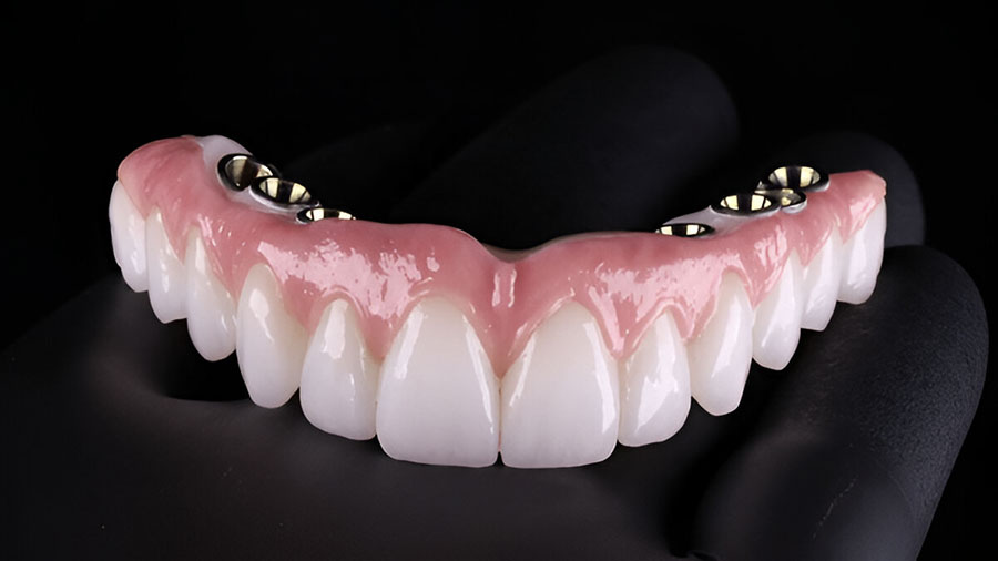 3Y-TZP Zirconia In Dental Ceramic Frameworks: A Comprehensive Overview 3Y-TZP Zirconia In Dental Ceramic Frameworks: A Comprehensive Overview