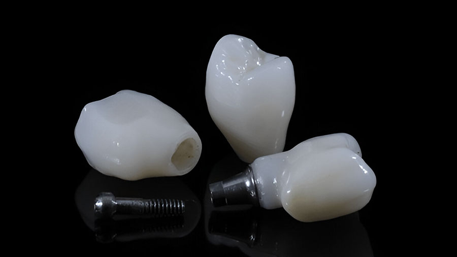 Fluorapatite Glass-Ceramics For Dental Restorations