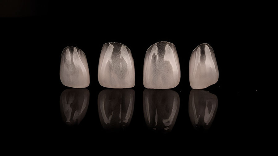 dental-lab-outsourcing-key-trends-for-2025