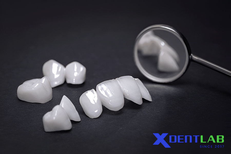 Classification of Dental Glass-Ceramics Classification of Dental Glass-Ceramics