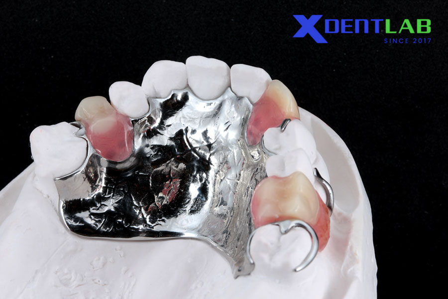 Khung Cobalt-Crom (Co-Cr) Khung Cobalt-Crom (Co-Cr)