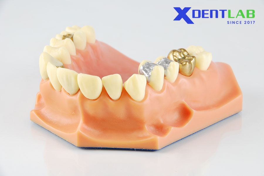 Khung Kim Loại Quý Khung Kim Loại Quý