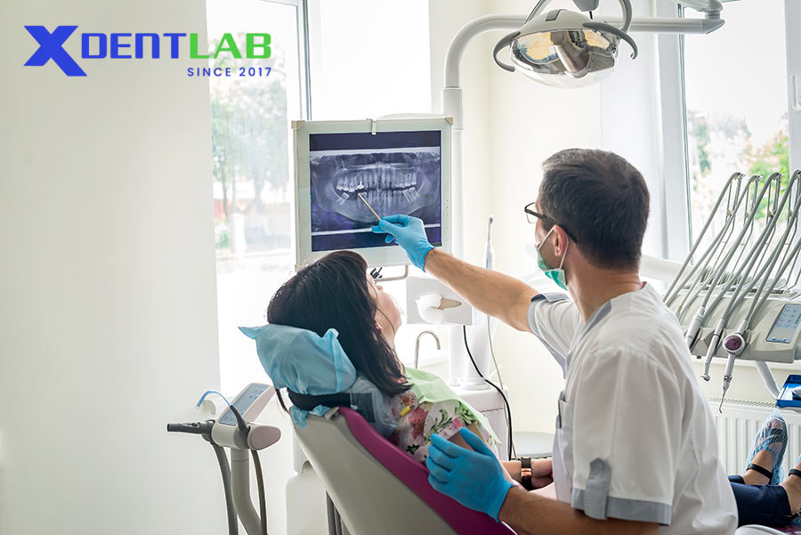 Biocompatibility: Conventional vs. Digital PMMA Biocompatibility: Conventional vs. Digital PMMA